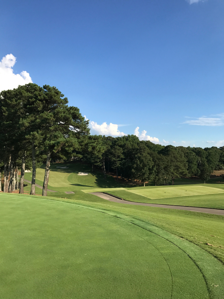 A well manicured golf course with hills and trees 